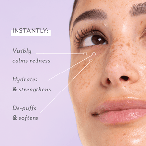 Patchology - Skin Remedy nyugató szemkörnyék-ápoló géltapasz 5pár