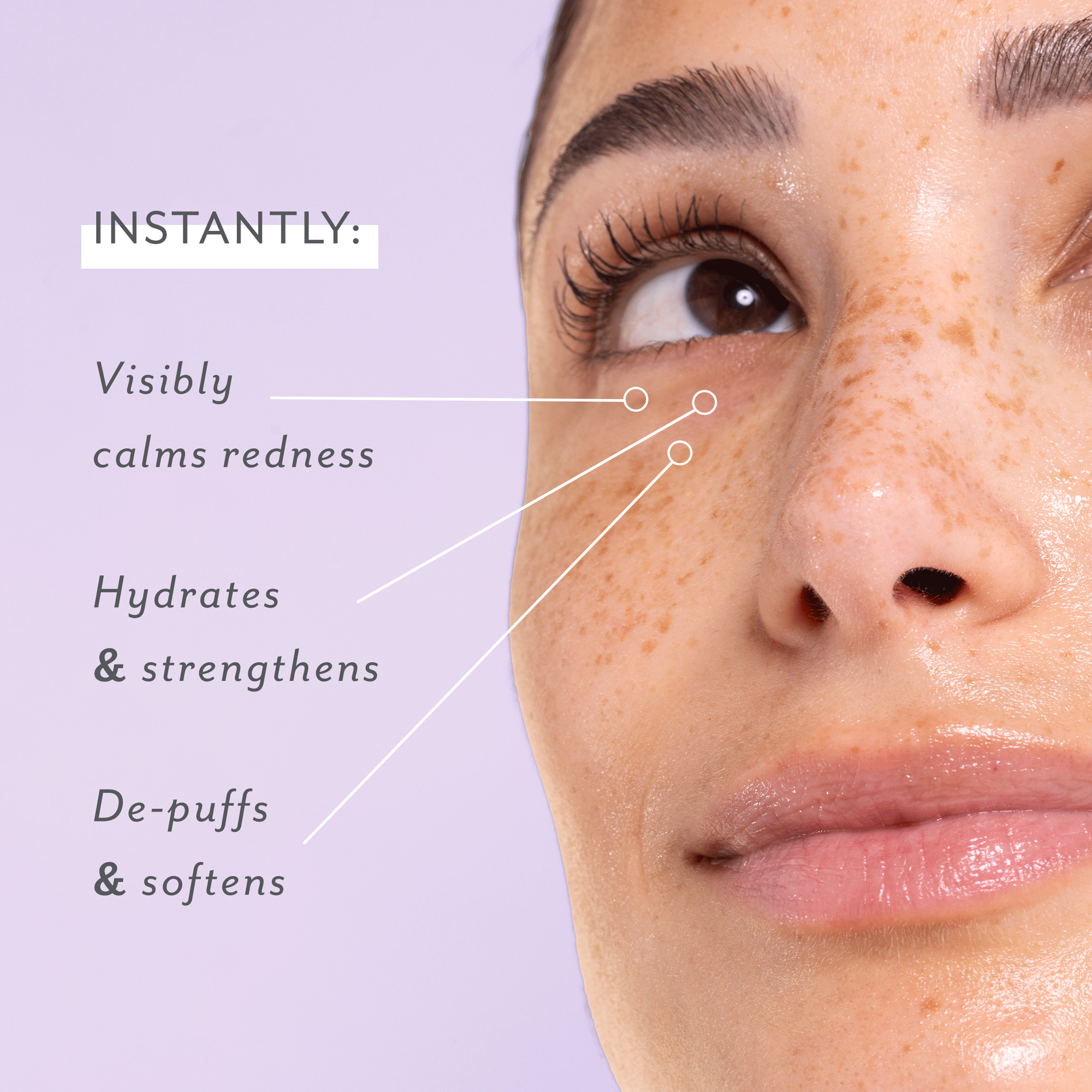 Patchology - Skin Remedy nyugató szemkörnyék-ápoló géltapasz 5pár 